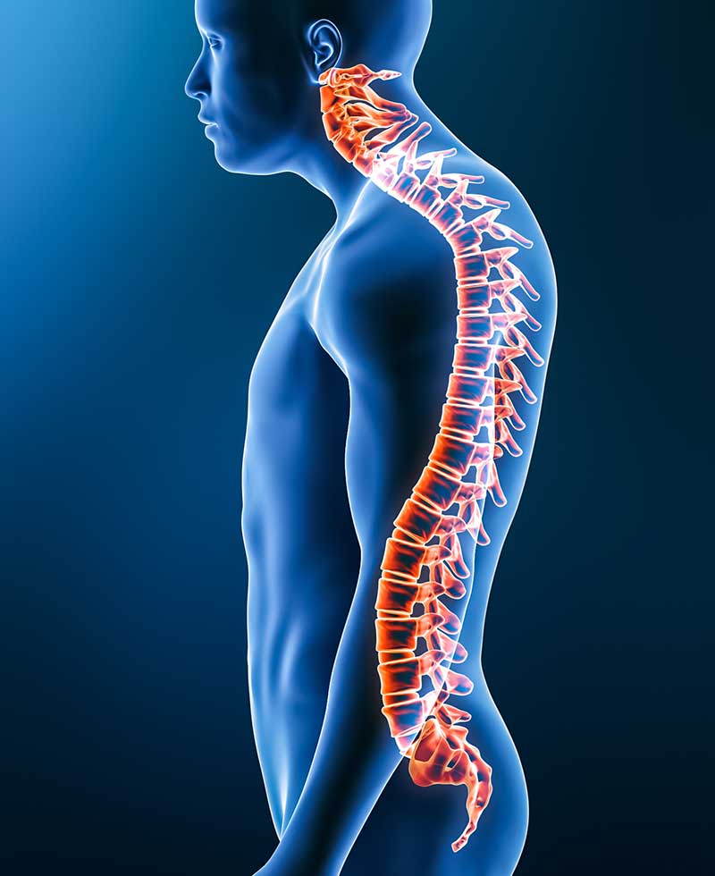 Kyphosis Huntington New York | Get Kyphosis Relief!