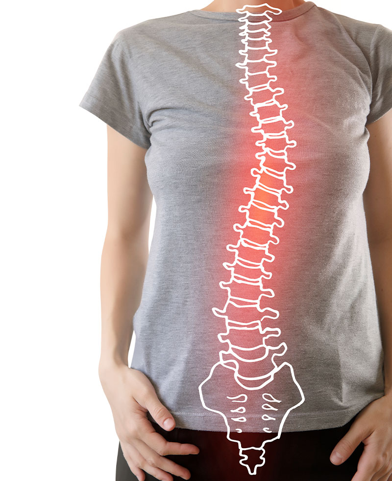 Patient suffering from scoliosis in need of scoliosis care at Waterfront Chiropractic in New York